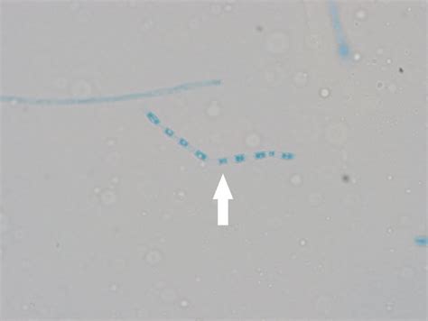 Coccidioides arthroconidia. | Download Scientific Diagram