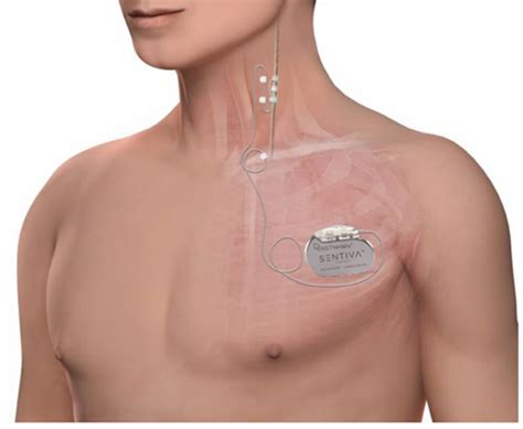 Epikurier Vagusnervstimulation