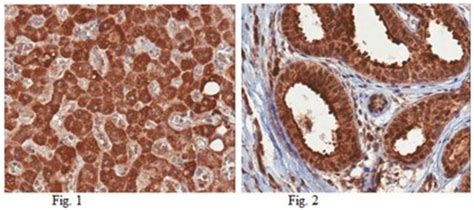 Anti HepaCAM 1 Antibody From Rabbit Purified By Affinity