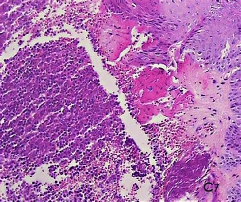 A Histological Photomicrograph Of Hematoxylin And Eosin Stained