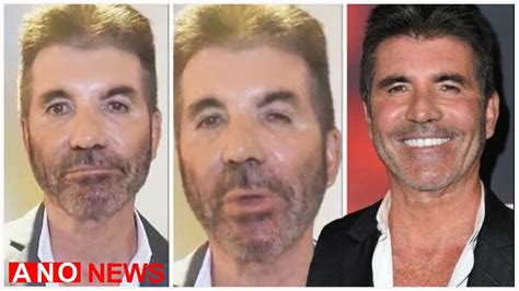 Simon Cowell Sparks Fan Concern As He Looks Unrecognisable In New