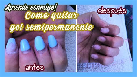 Aprender Acerca Imagen Como Quitar De Las U As El Gelish Abzlocal Mx