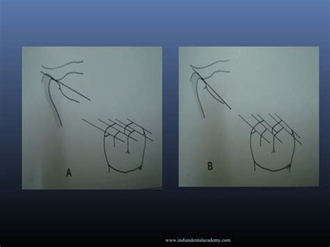 Fundamentals Of Occlusion Cosmetic Dentistry Courses Ppt