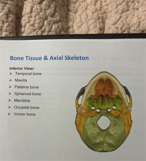 Solved Bone Tissue & Axial SkeletonInferior View:> ﻿Temporal | Chegg.com
