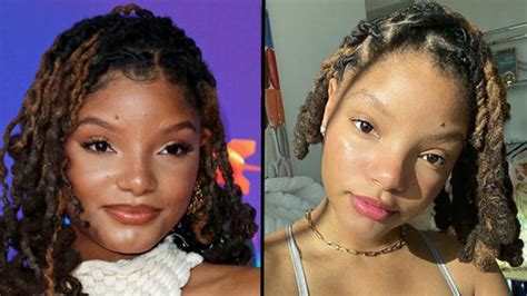 Halle Bailey Before And After Plastic Surgery