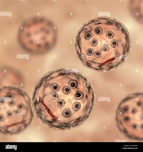 Cysts Of Entamoeba Coli Protozoan Computer Illustration E Coli Is A Non Pathogenic Amoeba