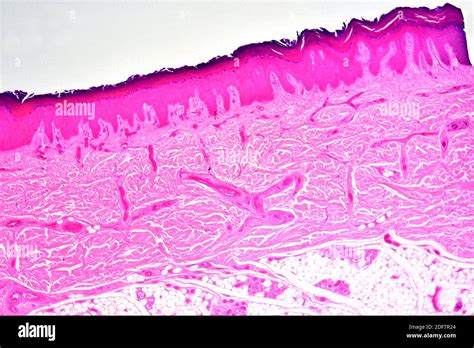 Keratinized Stratified Squamous Epithelium Skin
