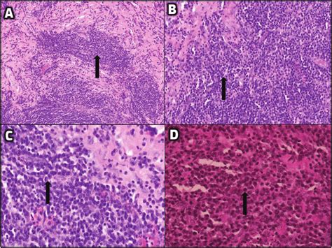 Representative Photomicrographs Hematoxylin And Eosin Stain Ax100 Download Scientific