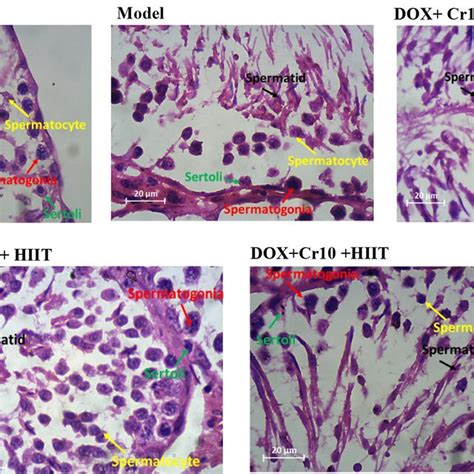 Hematoxylin And Eosin Hande Stained Slides From Rats Testicular