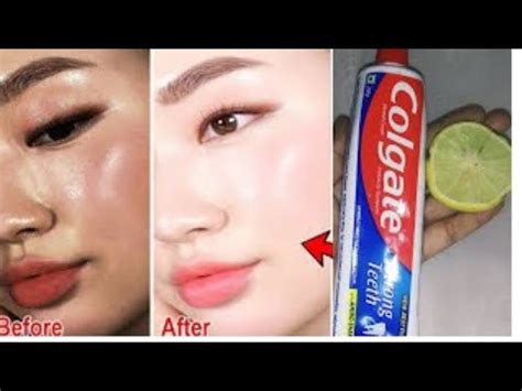 Colgate Se Skin Dark Se Light Karen Skin Bright Karne Ka Formula