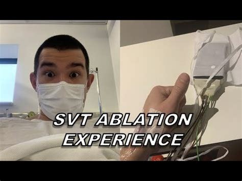 My SVT Surgery Experience | Catheter Ablation : r/surgery