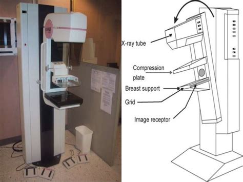 Mammography