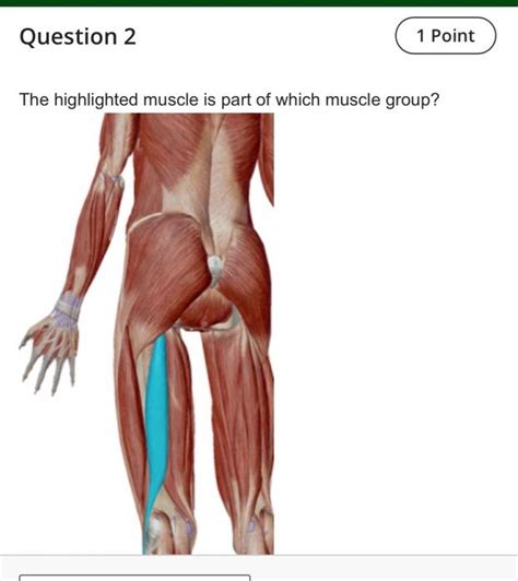 Solved The Highlighted Muscle Is Part Of Which Muscle Chegg