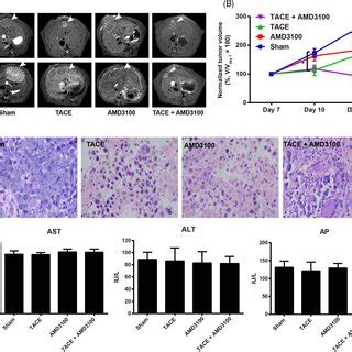 Amd Combined With Tace Regulates The Expression Of Hif And Vegf