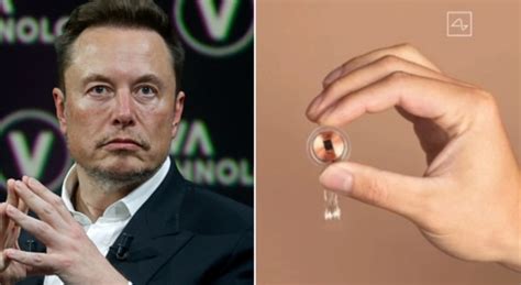 Elon Musk Impiantato Su Di Un Essere Umano Il Primo Chip Cerebrale