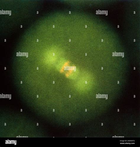 Double staining of DNA and microtubules of sea urchin. Anaphase of cell ...