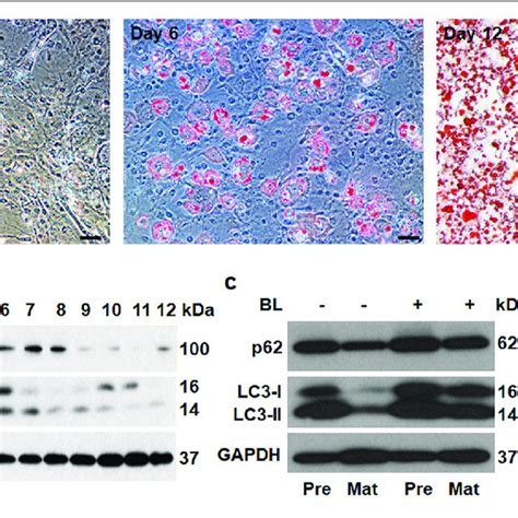 Adipogenesis Was Associated With Downregulation Of Sirt1 And Activation