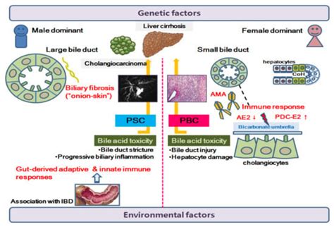 Biomedicines Free Full Text Primary Biliary Cholangitis And Primary