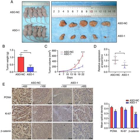 Linc01614 Knockdown Inhibits Tumorigenesis In Vivo A Xenograft Tumor