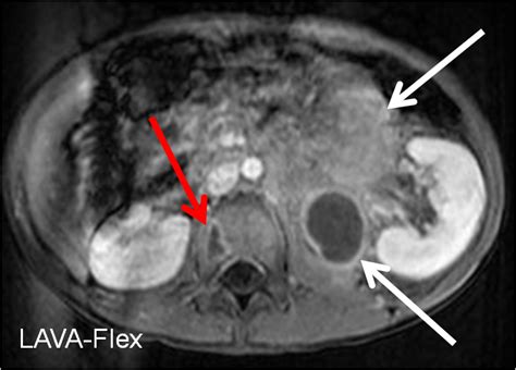 Pediatrics Radiologypics Com