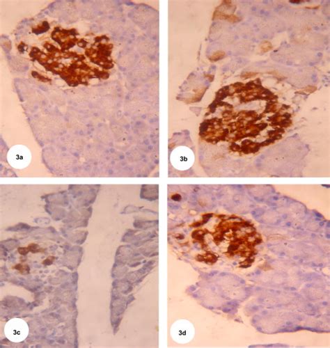 Immunohistochemistry Photomicrographs Of Immunohistochemical Staining