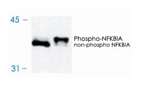 Nfkbia Mouse Clone 6a055 Abnova 100μg Unlabeledantibodies