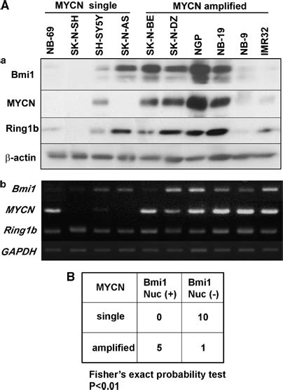 Bmi1 Expression Correlates With Mycn In Nb A Bmi1 Expression In Nb