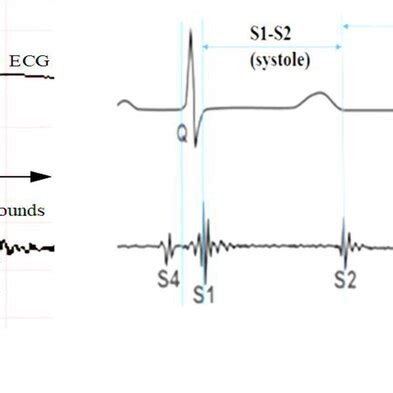 Heart Sounds. (a) normal, (b) abnormal | Download Scientific Diagram