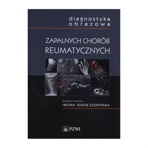 Diagnostyka Obrazowa Zapalnych Chor B Reumatycznych