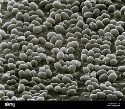 Bacillus Anthracis Sporen Scanning Electron Micrograph Sem Von