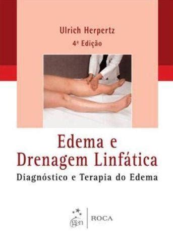 Livro Edema e Drenagem Linfática Diagnóstico e Terapia do Edema