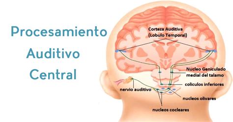 Procesamiento Auditivo Central Elisa Aribau