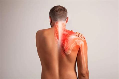 Osteopatia Dor No Pesco O Que Irradia Para O Ombro O Que Pode Ser