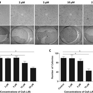 Antiproliferative Effect Of Csa A Morphological Changes After