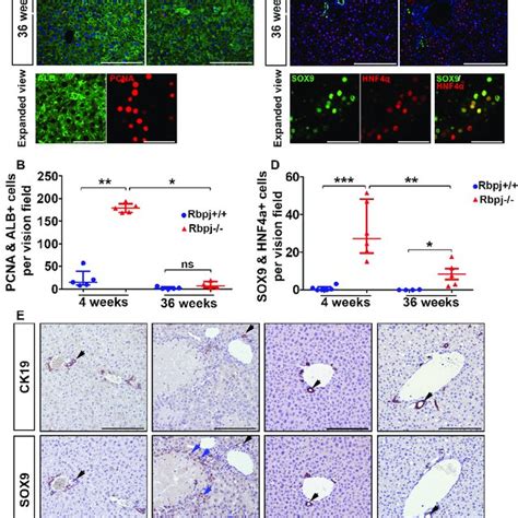 Regenerative Proliferation Upon Rbpj Deficiency Induced Cholestasis