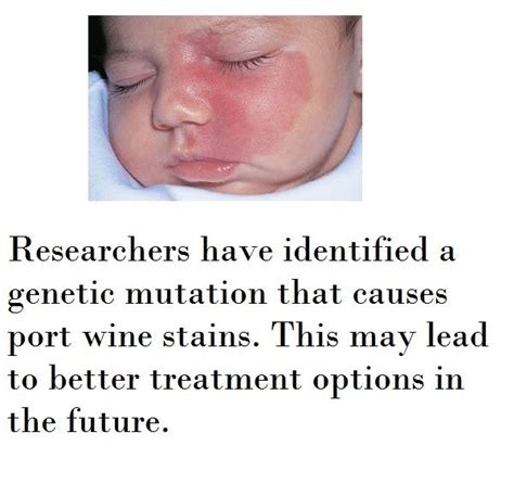 Researchers Have Identified The Underlying Genetic Mutation Responsible