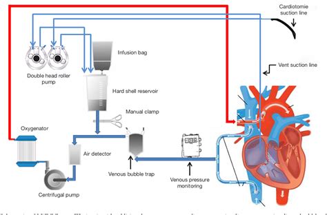 Figure 1 From The Main Challenge Of Modern Cardiac Perfusion