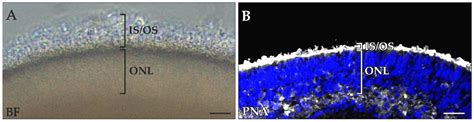 Ijms Free Full Text Transient Retention Of Photoreceptor Outer