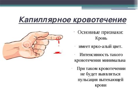 Как остановить кровь из пальца при глубоком порезе ножом: первая помощь ...
