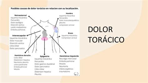 dolor toracico Lulú Torres uDocz