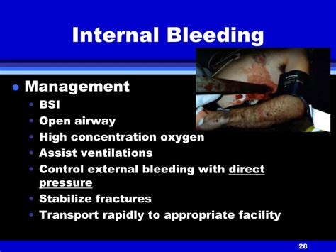 Ppt Shock And Bleeding Powerpoint Presentation Free Download Id