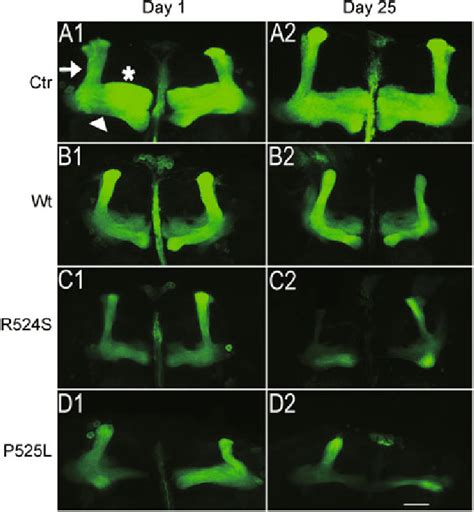 Expression Of Wt Or Mutant Fus In Mushroom Body Mb Neurons Leads To