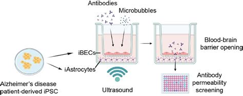 A Sporadic Alzheimer S Blood Brain Barrier Model For Developing