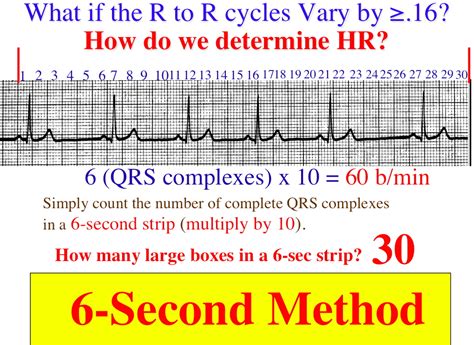 Ecg Heart Rate Calculation