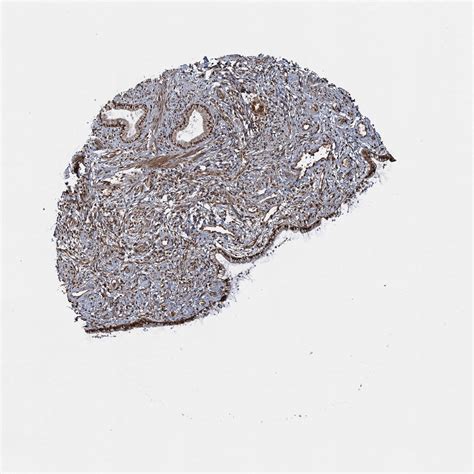 Tissue Expression Of Trim23 Staining In Cervix The Human Protein Atlas