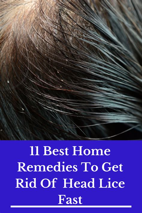 11 Best Home Remedies To Get Rid Of Lice Fast Artofit