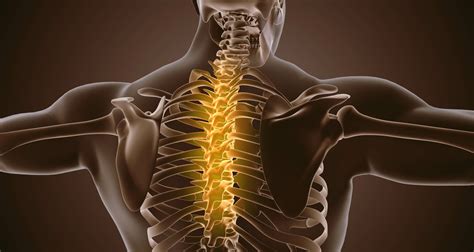 Espondilose Tor Cica Tem Cura Itc Vertebral