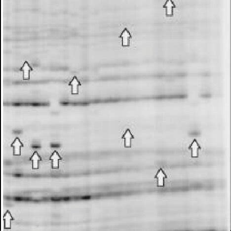 Autoradiography Of The REF The Labeled PCR Fragments From Colonies