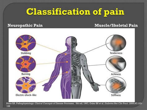 Ppt Neuropathic Pain Powerpoint Presentation Free Download Id7295757