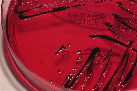 Salmonella On Xld Agar The Agar Used For Preparation Of Culture Media